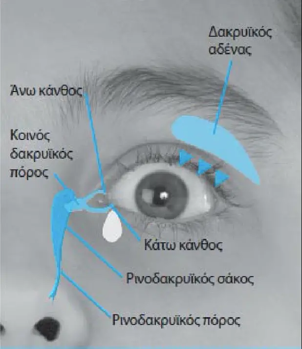 Απόφραξη_ρινοδακρυικού_πόρου.png